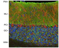 Immunocytochemistry/ Immunofluorescence - Anti-VILIP1 antibody [2D11] (AB187631), expandable thumbnail