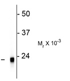 Western blot - Anti-VILIP1 antibody [2D11] (AB187631), expandable thumbnail