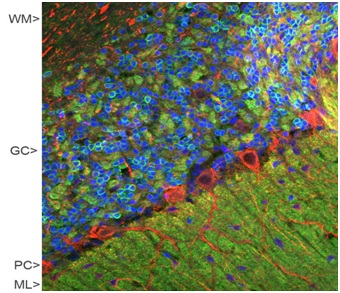 Immunocytochemistry/ Immunofluorescence - Anti-VILIP1 antibody (AB190372), expandable thumbnail