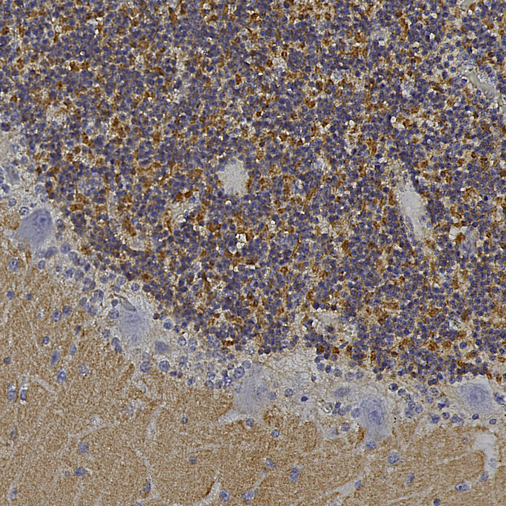 Immunohistochemistry (Formalin/PFA-fixed paraffin-embedded sections) - Anti-VILIP1 antibody (AB190372), expandable thumbnail