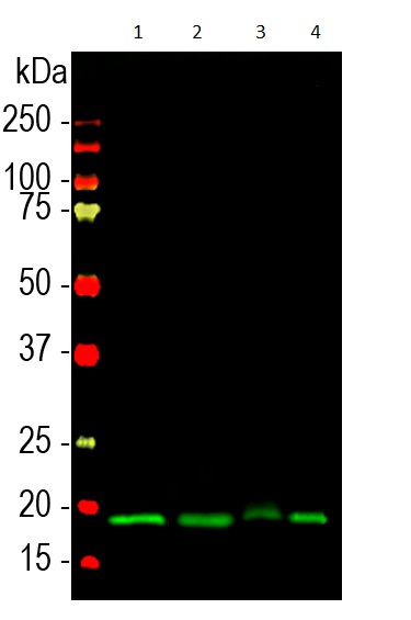 Western blot - Anti-VILIP1 antibody (AB190372), expandable thumbnail