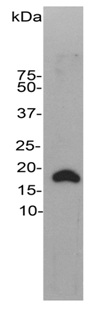 Western blot - Anti-VILIP1 antibody (AB190372), expandable thumbnail