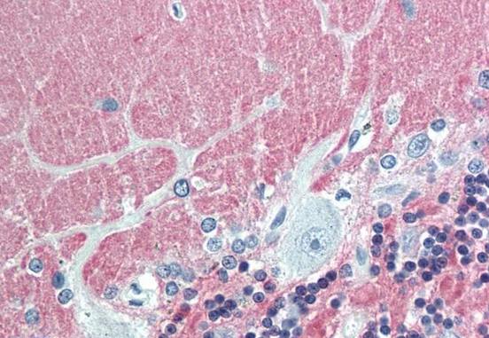 Immunohistochemistry (Formalin/PFA-fixed paraffin-embedded sections) - Anti-VILIP1 antibody (AB211465), expandable thumbnail
