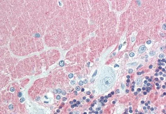 Immunohistochemistry (Formalin/PFA-fixed paraffin-embedded sections) - Anti-VILIP1 antibody (AB211465)