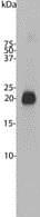 Western blot - Anti-VILIP1 antibody (AB211465), expandable thumbnail