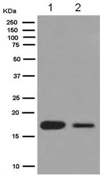 Western blot - Anti-VILIP1 antibody [EPR9832] (AB180141)