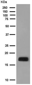 Western blot - Anti-VILIP1 antibody [EPR9832] (AB180141)