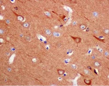 Immunohistochemistry (Formalin/PFA-fixed paraffin-embedded sections) - Anti-VILIP1 antibody [EPR9832] - BSA and Azide free (AB188105), expandable thumbnail