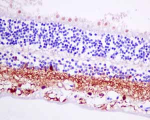 Immunohistochemistry (Formalin/PFA-fixed paraffin-embedded sections) - Anti-VILIP1 antibody [EPR9833] (AB151741), expandable thumbnail