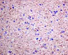 Immunohistochemistry (Formalin/PFA-fixed paraffin-embedded sections) - Anti-VILIP1 antibody [EPR9833] (AB151741), expandable thumbnail