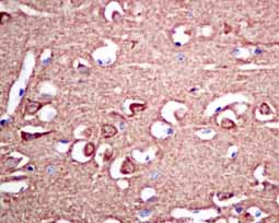 Immunohistochemistry (Formalin/PFA-fixed paraffin-embedded sections) - Anti-VILIP1 antibody [EPR9833] (AB151741), expandable thumbnail