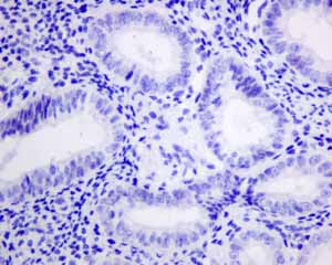 Immunohistochemistry (Formalin/PFA-fixed paraffin-embedded sections) - Anti-VILIP1 antibody [EPR9833] (ab151741), expandable thumbnail