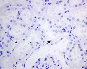 Immunohistochemistry (Formalin/PFA-fixed paraffin-embedded sections) - Anti-VILIP1 antibody [EPR9833] - BSA and Azide free (AB188106)