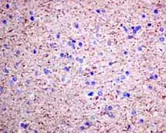 Immunohistochemistry (Formalin/PFA-fixed paraffin-embedded sections) - Anti-VILIP1 antibody [EPR9833] - BSA and Azide free (AB188106)