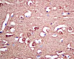 Immunohistochemistry (Formalin/PFA-fixed paraffin-embedded sections) - Anti-VILIP1 antibody [EPR9833] - BSA and Azide free (AB188106)