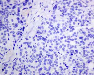Immunohistochemistry (Formalin/PFA-fixed paraffin-embedded sections) - Anti-VILIP1 antibody [EPR9833] - BSA and Azide free (AB188106)