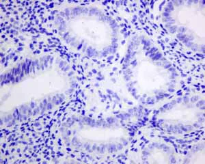 Immunohistochemistry (Formalin/PFA-fixed paraffin-embedded sections) - Anti-VILIP1 antibody [EPR9833] - BSA and Azide free (AB188106)