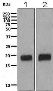 Western blot - Anti-VILIP1 antibody [EPR9833] - BSA and Azide free (AB188106)