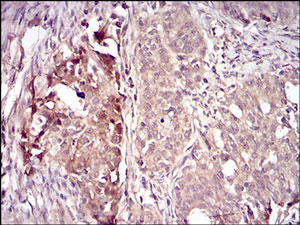 Immunohistochemistry (Formalin/PFA-fixed paraffin-embedded sections) - Anti-Villin antibody [3E5G11] - N-terminal (AB201989), expandable thumbnail