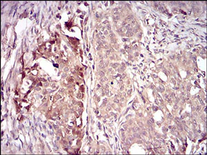 Immunohistochemistry (Formalin/PFA-fixed paraffin-embedded sections) - Anti-Villin antibody [3E5G11] - N-terminal (AB201989)