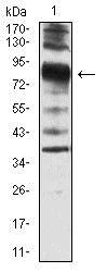 Western blot - Anti-Villin antibody [3E5G11] - N-terminal (AB201989)