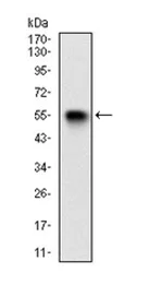 Western blot - Anti-Villin antibody [5E3B2] (AB202021)