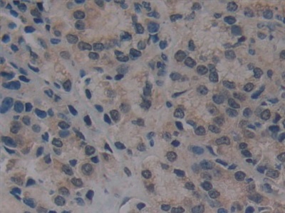 Immunohistochemistry (Formalin/PFA-fixed paraffin-embedded sections) - Anti-Villin antibody (AB233155), expandable thumbnail