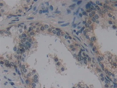 Immunohistochemistry (Formalin/PFA-fixed paraffin-embedded sections) - Anti-Villin antibody (AB233155)
