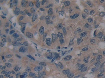 Immunohistochemistry (Formalin/PFA-fixed paraffin-embedded sections) - Anti-Villin antibody (AB233155), expandable thumbnail