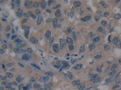 Immunohistochemistry (Formalin/PFA-fixed paraffin-embedded sections) - Anti-Villin antibody (AB233155)
