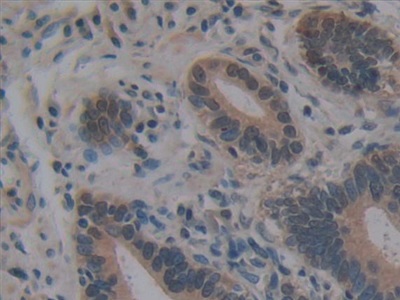 Immunohistochemistry (Formalin/PFA-fixed paraffin-embedded sections) - Anti-Villin antibody (AB233155), expandable thumbnail