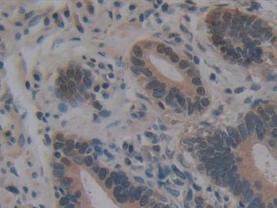 Immunohistochemistry (Formalin/PFA-fixed paraffin-embedded sections) - Anti-Villin antibody (AB233155)