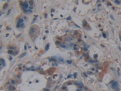 Immunohistochemistry (Formalin/PFA-fixed paraffin-embedded sections) - Anti-Villin antibody (AB233155), expandable thumbnail
