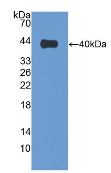 Western blot - Anti-Villin antibody (ab233155), expandable thumbnail