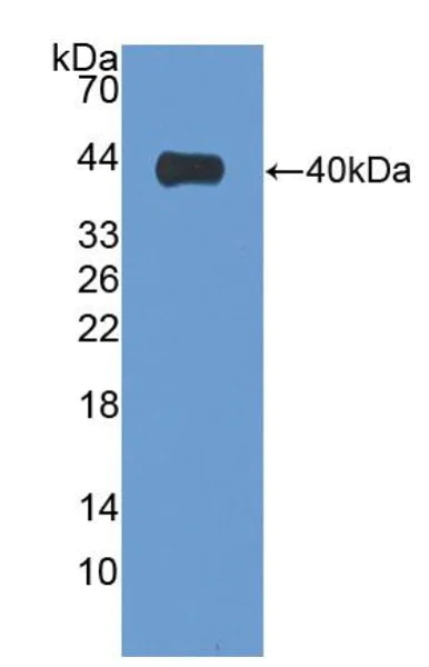 Western blot - Anti-Villin antibody (AB233155)
