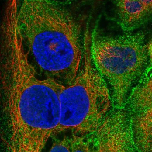 Immunocytochemistry/ Immunofluorescence - Anti-Villin antibody (AB244291)