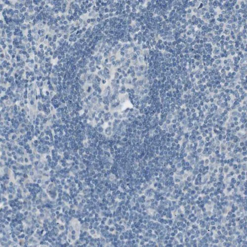 Immunohistochemistry (Formalin/PFA-fixed paraffin-embedded sections) - Anti-Villin antibody (AB244291)