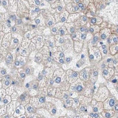 Immunohistochemistry (Formalin/PFA-fixed paraffin-embedded sections) - Anti-Villin antibody (AB244291)