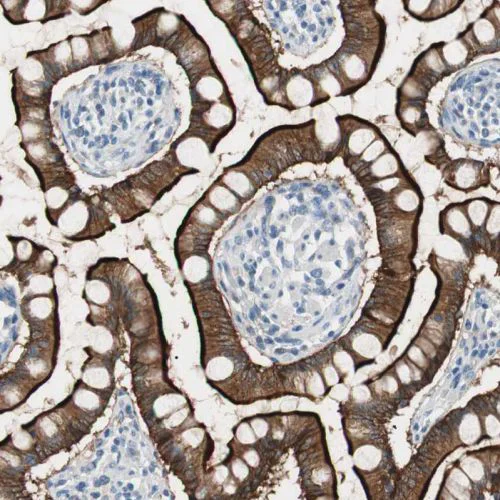 Immunohistochemistry (Formalin/PFA-fixed paraffin-embedded sections) - Anti-Villin antibody (AB244291)