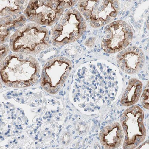 Immunohistochemistry (Formalin/PFA-fixed paraffin-embedded sections) - Anti-Villin antibody (AB244291)