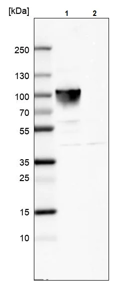 Western blot - Anti-Villin antibody (AB244291)