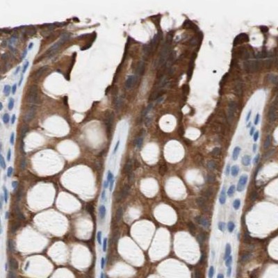 Immunohistochemistry (Formalin/PFA-fixed paraffin-embedded sections) - Anti-Villin antibody (AB244292)
