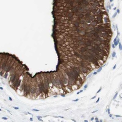 Immunohistochemistry (Formalin/PFA-fixed paraffin-embedded sections) - Anti-Villin antibody (AB244292)