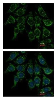 Immunocytochemistry/ Immunofluorescence - Anti-Villin antibody (AB272876)