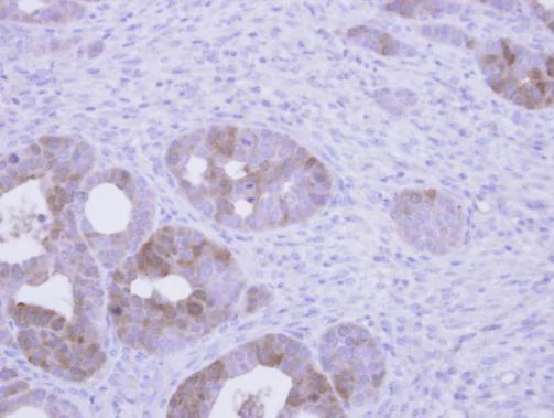 Immunohistochemistry (Formalin/PFA-fixed paraffin-embedded sections) - Anti-Villin antibody (AB272876)