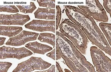 Immunohistochemistry (Formalin/PFA-fixed paraffin-embedded sections) - Anti-Villin antibody (AB272876)