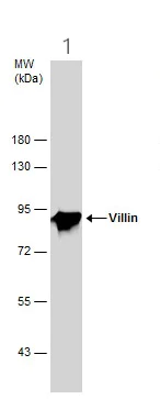 Western blot - Anti-Villin antibody (AB272876)