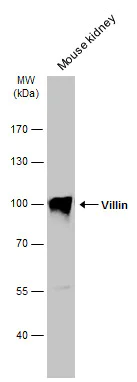 Western blot - Anti-Villin antibody (AB272876)
