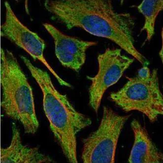 Immunocytochemistry/ Immunofluorescence - Anti-Villin antibody (AB97512)