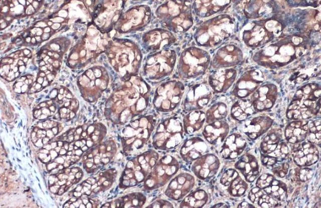 Immunohistochemistry (Formalin/PFA-fixed paraffin-embedded sections) - Anti-Villin antibody (AB97512)